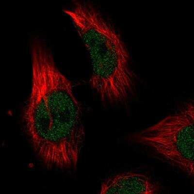 Immunocytochemistry/ Immunofluorescence: ILKAP/PP2C delta Antibody [NBP2-76549]