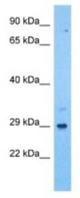 Western Blot: ILT11/LILRA5 Antibody [NBP3-10013]
