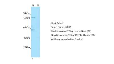 Western Blot: ILT4/CD85d/LILRB2 Antibody [NBP1-98554]