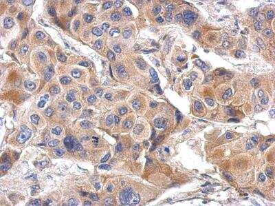 Immunohistochemistry-Paraffin: ILT7/CD85g/LILRA4 Antibody [NBP2-15012]