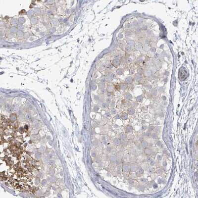 Immunohistochemistry-Paraffin: ILT7/CD85g/LILRA4 Antibody [NBP2-48932]
