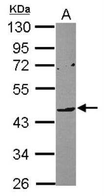 Western Blot: ILT7/CD85g/LILRA4 Antibody [NBP2-15012]