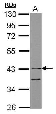 Western Blot: ILT7/CD85g/LILRA4 Antibody [NBP2-15013]