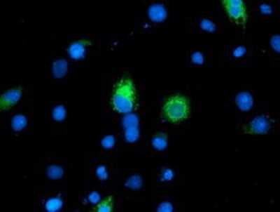 Immunocytochemistry/ Immunofluorescence: ILVBL Antibody (OTI8B12) [NBP2-00883]