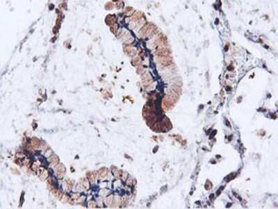 Immunohistochemistry-Paraffin: ILVBL Antibody (OTI8B12) [NBP2-00883]