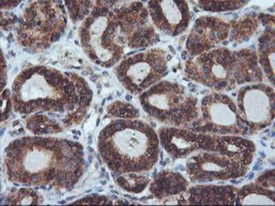 Immunohistochemistry-Paraffin: ILVBL Antibody (OTI8B12) [NBP2-00883]