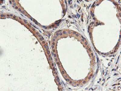 Immunohistochemistry-Paraffin: ILVBL Antibody (OTI8B12) [NBP2-00883]