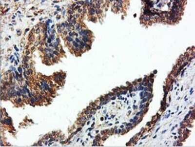 Immunohistochemistry-Paraffin: ILVBL Antibody (OTI8B12) [NBP2-00883]