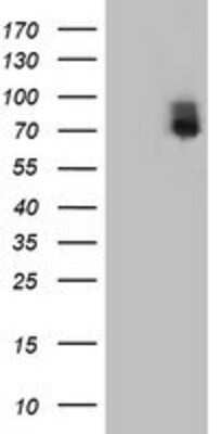 Western Blot: ILVBL Antibody (OTI8B12) [NBP2-00883]
