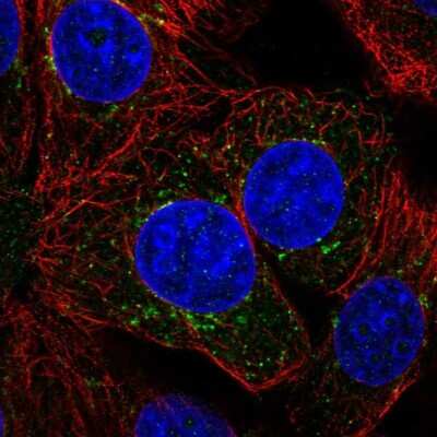 Immunocytochemistry/ Immunofluorescence: ILVBL Antibody [NBP2-49524]
