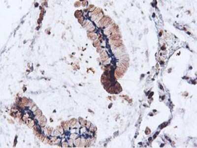 Immunohistochemistry: ILVBL Antibody (OTI8B12) - Azide and BSA Free [NBP2-71661]
