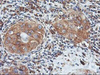 Immunohistochemistry: ILVBL Antibody (OTI8B12) - Azide and BSA Free [NBP2-71661]