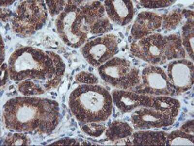 Immunohistochemistry: ILVBL Antibody (OTI8B12) - Azide and BSA Free [NBP2-71661]