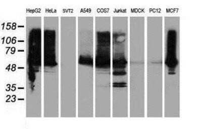 Western Blot: ILVBL Antibody (OTI8B12)Azide and BSA Free [NBP2-71661]