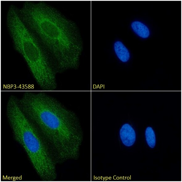 Cytokeratin 8/18 Antibody (COU-1) - Chimeric - BSA Free Cytokeratin 8/18 Antibody (COU-1) - Chimeric - BSA Free
