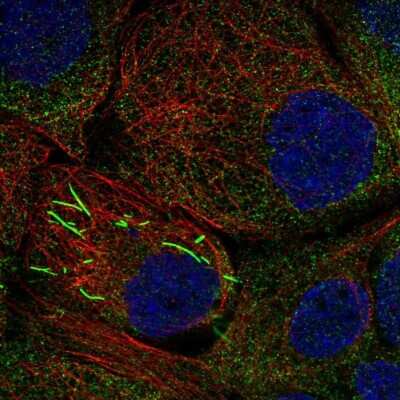 Immunocytochemistry/ Immunofluorescence: IMP Dehydrogenase 2/IMPDH2 Antibody [NBP1-86177]