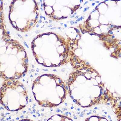 Immunohistochemistry-Paraffin: IMP2/IGF2BP2 Antibody (2O3W8) [NBP3-16585]
