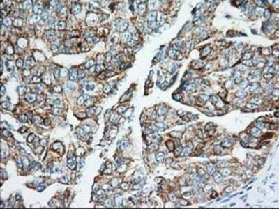 Immunohistochemistry: IMP2/IGF2BP2 Antibody (OTI3F9) - Azide and BSA Free [NBP2-71615]