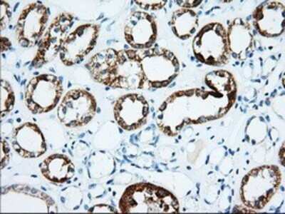 Immunohistochemistry: IMP2/IGF2BP2 Antibody (OTI3F9) - Azide and BSA Free [NBP2-71615]