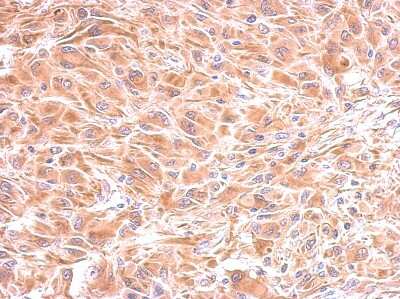 Immunohistochemistry-Paraffin: IMPA1 Antibody [NBP2-16963]