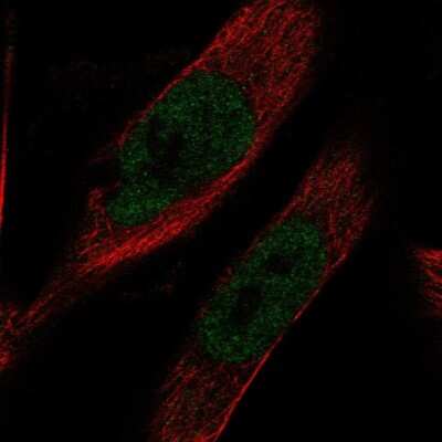 Immunocytochemistry/ Immunofluorescence: IMPACT Antibody [NBP1-86221]