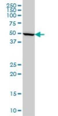 Western Blot: IMPDH1 Antibody (3G6) [H00003614-M01]