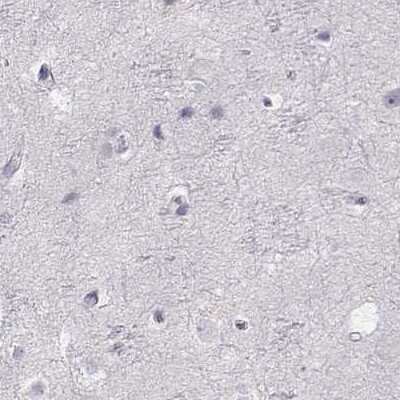 Immunohistochemistry-Paraffin: IMPG1 Antibody [NBP2-55575]