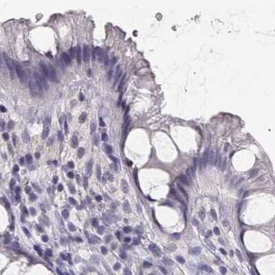Immunohistochemistry-Paraffin: IMPG1 Antibody [NBP2-55575]