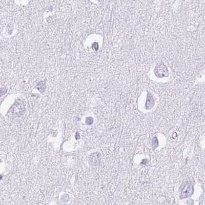 Immunohistochemistry-Paraffin: IMPG1 Antibody [NBP2-57460]