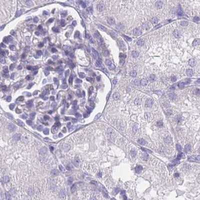 Immunohistochemistry-Paraffin: IMPG1 Antibody [NBP2-57460]