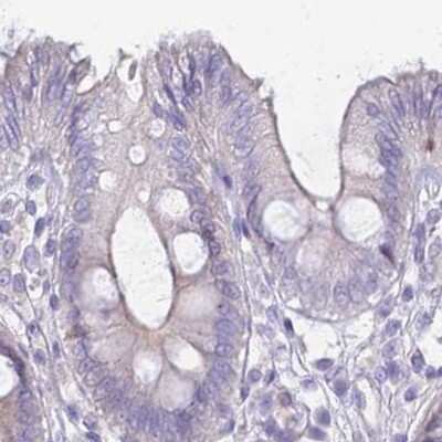 Immunohistochemistry-Paraffin: IMPG1 Antibody [NBP2-57460]