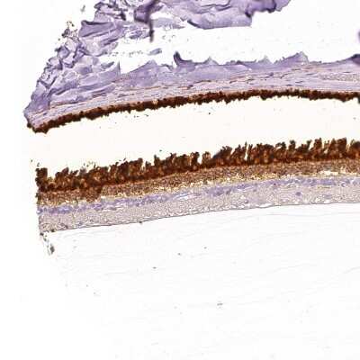 Immunohistochemistry-Paraffin: IMPG1 Antibody [NBP2-57460]