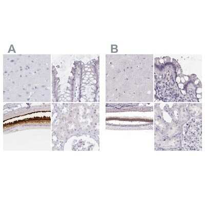 Immunohistochemistry-Paraffin: IMPG1 Antibody [NBP2-57461]