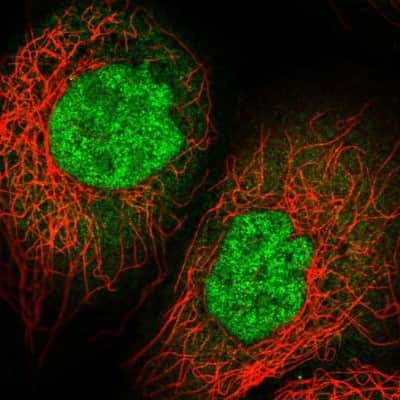 Immunocytochemistry/ Immunofluorescence: IMUP Antibody [NBP2-14392]