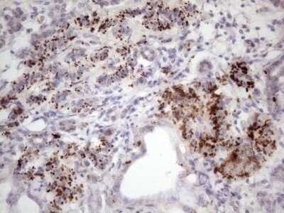 Immunohistochemistry: INAVA Antibody (OTI6A6) - Azide and BSA Free [NBP2-72021]