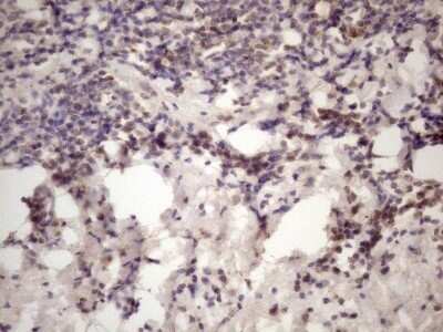 Immunohistochemistry: INAVA Antibody (OTI6A6) - Azide and BSA Free [NBP2-72021]