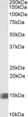 Western Blot: INCA Antibody [NBP1-46144]