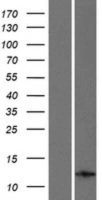 Western Blot: INCA Overexpression Lysate [NBP2-10988]