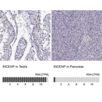 Immunohistochemistry-Paraffin: INCENP Antibody [NBP2-62620]