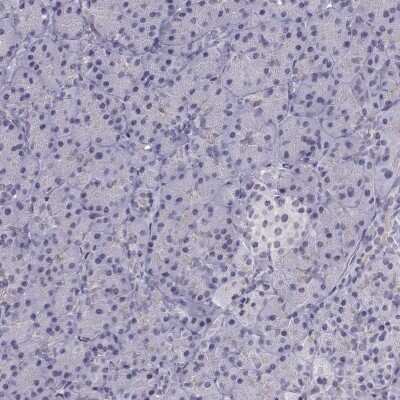 Immunohistochemistry-Paraffin: INCENP Antibody [NBP2-62620]