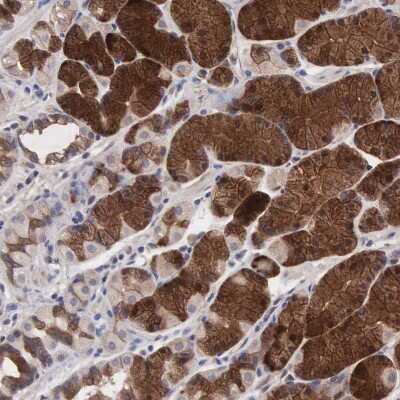 Immunohistochemistry-Paraffin: INF2 Antibody [NBP1-88414]
