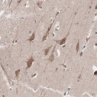 Immunohistochemistry-Paraffin: INF2 Antibody [NBP1-88414]