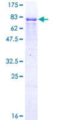 SDS-PAGE: Recombinant Human ING3 GST (N-Term) Protein [H00054556-P02]