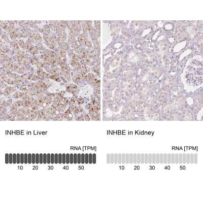 Immunohistochemistry-Paraffin: INHBE Antibody [NBP1-89262]