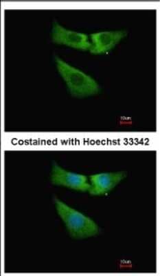 Immunocytochemistry/ Immunofluorescence: INMT Antibody [NBP2-16967]