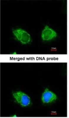 Immunocytochemistry/ Immunofluorescence: INPP1 Antibody [NBP1-31475]
