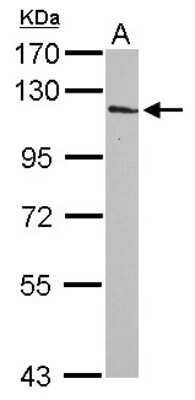 Western Blot: INPP4A Antibody [NBP2-16968]