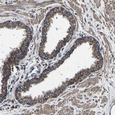 Immunohistochemistry-Paraffin: INPP5A Antibody [NBP1-89361]