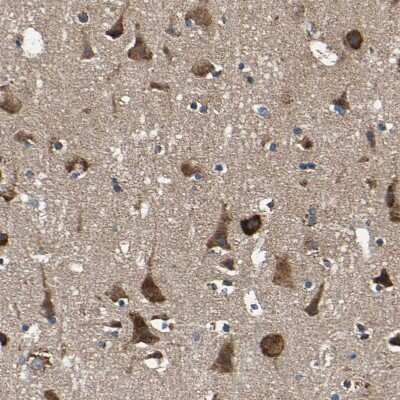 Immunohistochemistry-Paraffin: INPP5A Antibody [NBP1-89361]