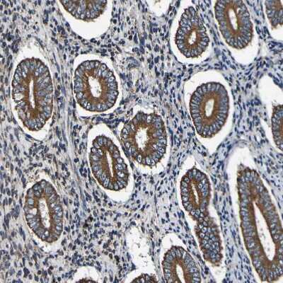 Immunohistochemistry-Paraffin: INPP5A Antibody [NBP1-89361]